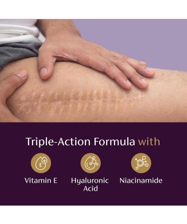 Mederma Scar Serum Triple-Action Formula with Vitamin E Hyaluronic Acid & Niacinamide Clinically Shown to Reduce Old Scars 1 Fl. Oz. - Buy Online on GoSupps.com