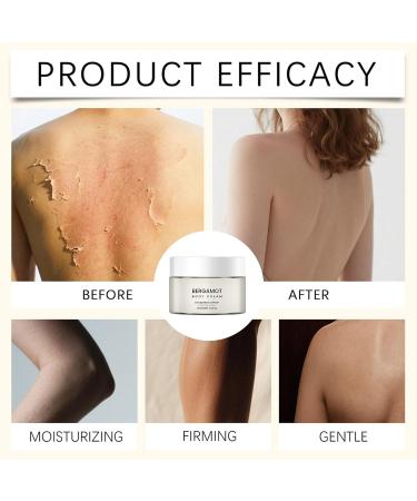 Cr me pour le Corps | Soin Hydratant claircissant - 100g Lotion Corporelle Absorption Rapide Pour Peau S che | Pour Hommes Femmes Mains Pieds Secs Sensibles Fissur s Voyage Quotidien - Buy Online on GoSupps.com