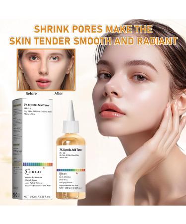 7% Glycolic Acid Exfoliating Toner Exfoliating Facial Toner Pore Minimizing Toner Smooth Skin Even Tone Hydrating Formula 3.38 Fl Oz (Pack of 1) - Buy Online on GoSupps.com