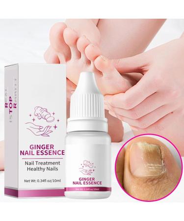 Nail Softener - Nail Strengthening Oil 10ml - Moisturizing Repair Care Nails Hands And Feet Sensitive Skin Men Women Daily Use Night Travel Manicure Pedicure - Buy Online on GoSupps.com