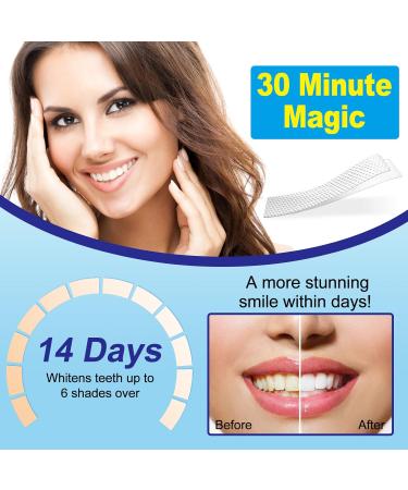 Teeth Whitening Strips - 14 Treatments | Enamel Safe & Effective Home Use - Whiter Teeth Without Harm - Buy Online on GoSupps.com