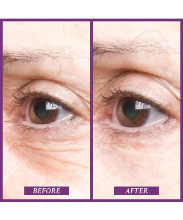 PRAI Beauty Ageless Eye Uplift Serum 15ml - Youthful Eye Treatment - Buy Online on GoSupps.com