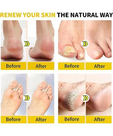 2023 New Foot Medication Effervescent Pills - Essential Oil Soaking Tablets for Relaxation | Foot Bath Soak & Massage (2 Box) - International Shipping - Buy Online on GoSupps.com