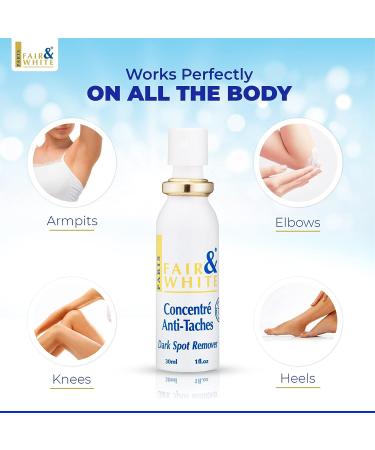 Fair & White Original Dark Spot Remover - 1 fl oz - Hyperpigmentation Cream for Even Skin Tone, Wrinkle Reduction & Sun Damage Repair - Buy Online on GoSupps.com