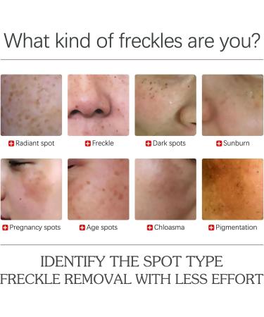 KOAHDE Fade Pigment Facial Serum Whitening Freckle Serum Remove Dark Spot Facial Serum Fade Melanin Facial Serum Melanin Correcting Skin Care Serum Brighten Facial Serum Pigment Care Serums 30ML - Buy Online on GoSupps.com