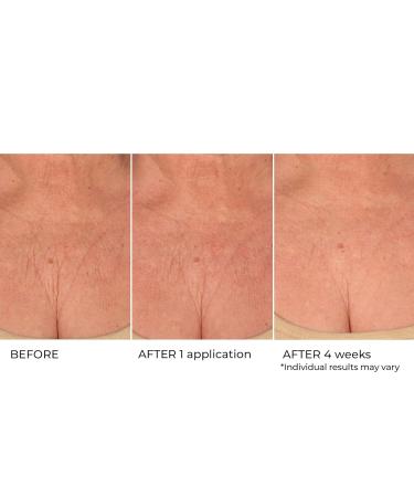 Age Defying Neck & Decollete Treatment Serum - Firm & Tighten Sagging Skin | Best Neck Wrinkle Serum - Buy Online on GoSupps.com