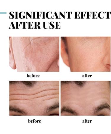 Mens Moisturiser Face for Anti-Aging Skin Tightening Face Cream for Hydration Natural Anti Wrinkle Day Face Cream Anti Aging Moisturiser with Hyaluronic Acid Anti Aging Facial Moisturizer 50g - Buy Online on GoSupps.com