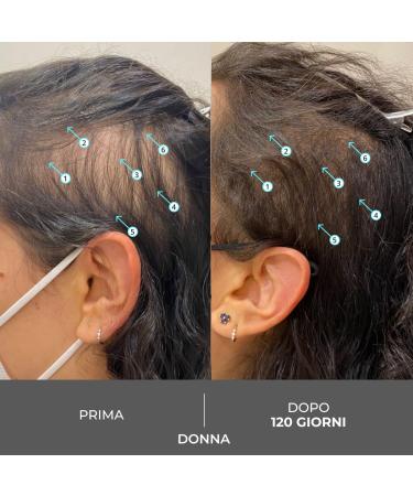 DS Laboratories Revita Extra Strength Shampoo - Anti-Hair Loss & DHT Blocker for Men & Women | Biotin Hair Growth Solution - Buy Online on GoSupps.com