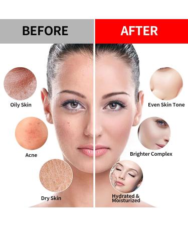 Nielies Vampire & Chamomile Patel Jelly Mask Set for Instant Hydration & Anti-Aging - Buy Online on GoSupps.com