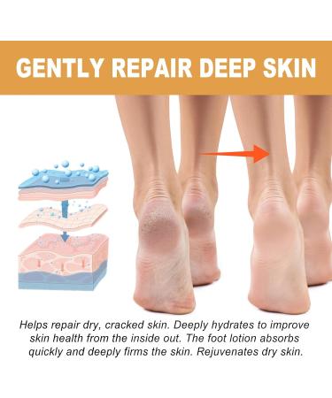 Tongyend Foot Peeling Spray Instant Foot Peeling Spray Foot Callus Removal Spray Moisturizing Hydrating Nourish Peel off Spray Foot Exfoliating Spray Remove Foot Dead Skin-30ML FootCallusRemover - Buy Online on GoSupps.com