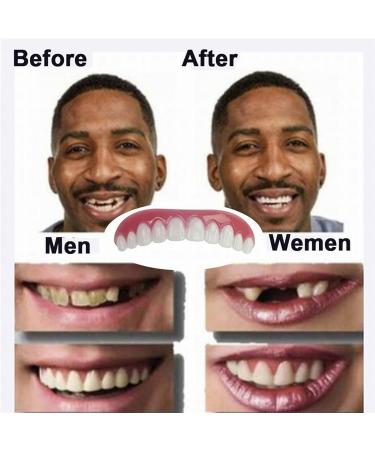 Cakunmik Silicone Tooth Replacement - Perfect Removable Natural False Teeth Veneers | No Pain No Shots 2 Pairs for a Confident Smile - Buy Online on GoSupps.com