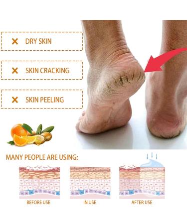 Hand Cream Rough Foot Care Cream Foot Cream For Cracked Heel Moisturizer Cream for Hand and Foot 40g Natural Nourishing Hand and Foot Care Cream Deep Hydrating & Smooth Dull Skin - Buy Online on GoSupps.com