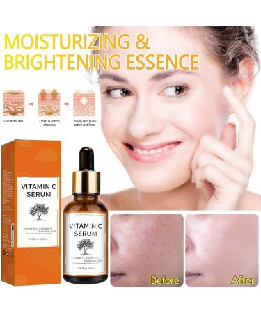 Bio Face Serum with Vitamin C Hyaluronic Acid and Vitamin C Vitamin C Serum Anti-wrinkle Anti-spot Anti-aging and Moisturizing. Also Ideal As Eye Cream (1pc) - Buy Online on GoSupps.com