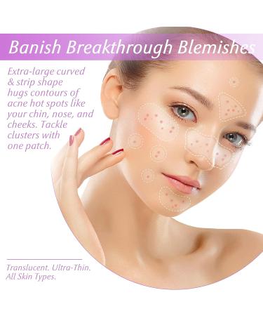 Acne Pimple Patches for Large Zit Breakouts - 102 Hydrocolloid Bandages with Tea Tree & Salicylic Acid - Buy Online on GoSupps.com