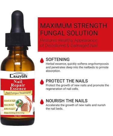 Fungal Nail Treatment - Nail Fungus Treatment for Toenail - Extra Strong Nail Fungus Treatment for Toenail - Anti fungus Nail Repair and Strengthen Fix & Renew Damaged Broken Nails - Buy Online on GoSupps.com