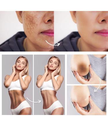 FAMIROSA Dark Spot Corrector for Face and Body: Dark Dpot Remover for Intimate Areas Neck Underarms Elbows Knees Bikini - Rapid Tone Repair Cream 1.7 fl oz (50ml) - Buy Online on GoSupps.com