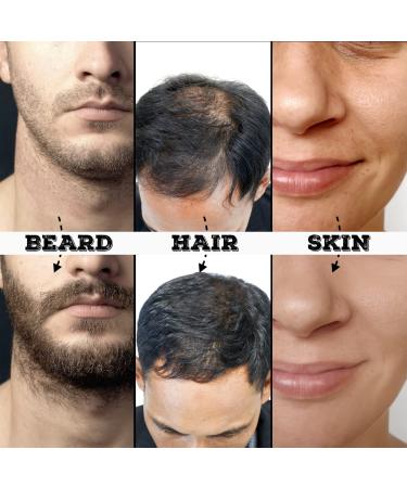 Beard Kit - Derma Roller for Facial Hair Growth & Skin Care | 0.25mm Beard Care Tools - Buy Online on GoSupps.com
