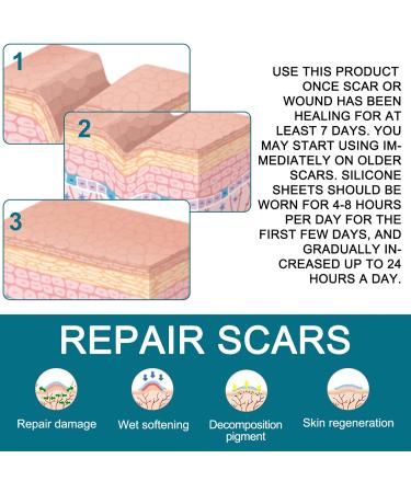 Silicone Scar Sheets(1.6"x125"-3.2M) Medical Grade Silicone Scar Tape Silicone Strips for Scar Healing Painless Scar Removal Tape for All Surgical Incisions C-Section Burn Keloid Acne 1.6"x125"-3.2M 1.6"x125"-3.2m - Buy Online on GoSupps.com