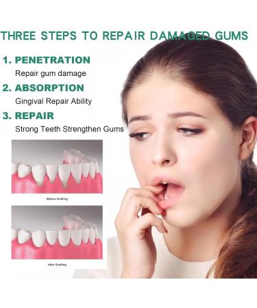 Natural Gum Regrowth & Repair Drops - Effective Oral Care Relief (5PC) - Buy Online on GoSupps.com