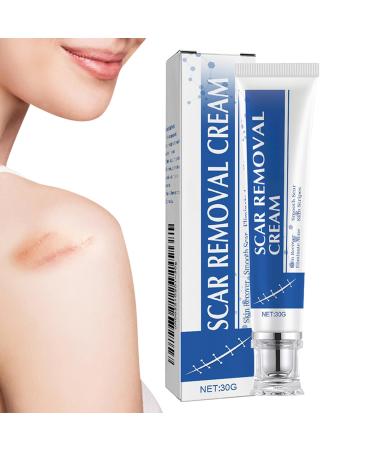 Anti-Scars Cream | 30g Repair Product Repairing Cream for Old Scars For Recovery Wound Cheloids Women Men Athletes