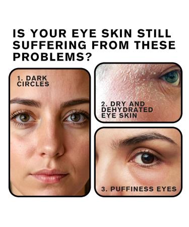 Tiksec Castor Oil and Frankincense Eye Roller Castor Oil Under Eye Roller Castor Oil Frankincense Rollerball Moisturizing Anti-Wrinkle and Fine Line (2) - Buy Online on GoSupps.com