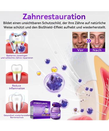 Ackluck Hydroxylapatite Tooth Repair Powder Breath Freshener and Stain Removal Powder Tooth Melt Protection Sensitive Teeth Before Meals Daily Night 30 g - Buy Online on GoSupps.com