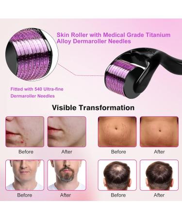 Derma Scooter Needles 0.25mm - 540 Titan Micron Facial Roller for Home Use | Smooth Skin Reduce Scars & Enhance Beauty - Buy Online on GoSupps.com