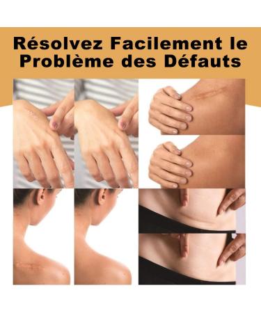 Autocollant Cicatrice Invisible Patch Peau Imperm able et Respirant pour Dissimulation Tatouage Correcteur Opaque Ultra Fin et Doux Ruban Camouflage Cicatrices et Marques Cutan es - Buy Online on GoSupps.com