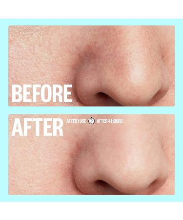 Peace Out Pores Hydrocolloid Nose & Face Strips with Vitamin A - Enlarged Pore Refining & Oil Control (4 Pore & 4 Nose Strips) - Buy Online on GoSupps.com