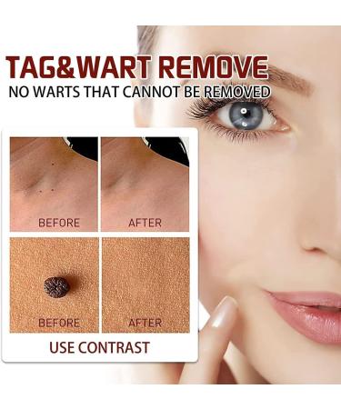 ZHBiwmatn 2024 New 5Pcs Wipe Off and Extreme Skin Wipe Off & Fast Easy to for Face Armpit Flesh Neck 3ml - Buy Online on GoSupps.com