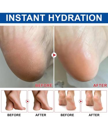 MEITREND Foot cream with 60 urea for very dry rough and cracked skin urea cream 60 for foot care anticracking foot cream moisturizing foot cream for feet and hands - Buy Online on GoSupps.com
