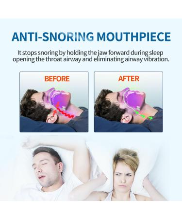 Buy Anti Snoring Devices - Effective Snoring Solutions for Men & Women | International Shipping Available - Buy Online on GoSupps.com