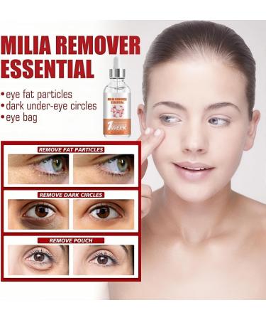 Milia S rum d maquillant pour le contour des yeux S rum facial contre les miliums et les taches brunes pour homme et femme r duit le rel chement de la peau les gonflements et les ridules 30 ml 1 pi ce. - Buy Online on GoSupps.com