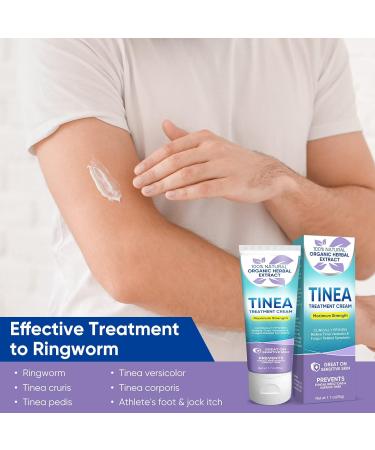 Tinea Versicolor Natural Skin Cream - Effective Treatment for All Skin Types - Buy Online on GoSupps.com
