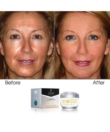 Age Defying Lifting Day Cream Treatment - Youthful Skin Global Shipping - Buy Online on GoSupps.com