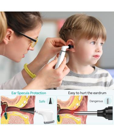 ScopeAround Wireless Otoscope Ear Camera Kit - 3.9mm Visual Scope for Ear Wax Removal - 6 LED Lights - Android/iPhone/iPad Compatible - White - Buy Online on GoSupps.com