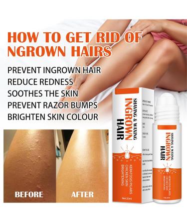 Fashion Base Ingrown Hair Treatment Roll-On - Reduce Razor Bumps and Ingrown Hairs - Soothing Serum for Ingrow Solutions - After Shave Ingrown Hair Reduction - Buy Online on GoSupps.com