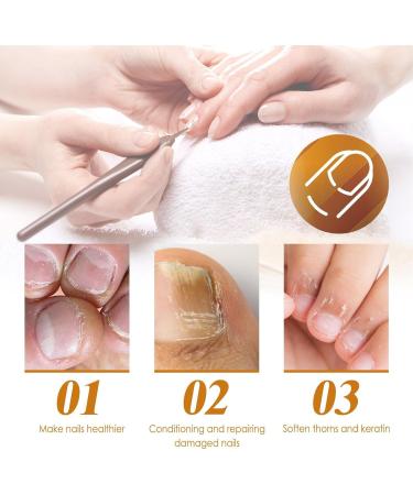  szaluyk Cuticle Removal Gel for Nails | Professional Cuticle Softener | 1oz Instant Gel | Fast-Acting 15s Formula | Moisturizes Damaged Skin | Nail Repair | Nail Care - Buy Online on GoSupps.com