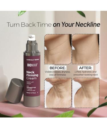 bioniva Neck Cream for Tightening and Firming with 4D Hyaluronic Acid Complex for Multi-Layer Hydration System & 24-Hour Deep Moisture Collagen Support Skin Lifting Elasticity & Protection 50mL 1.6 Fl Oz (Pack of 1) - Buy Online on GoSupps.com