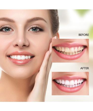 Teeth Whitening Pen 3 Pack - Safe 30% Carbamide Peroxide Gel No Sensitivity & Painless Travel-Friendly Whitening for a Dazzling Smile - Buy Online on GoSupps.com