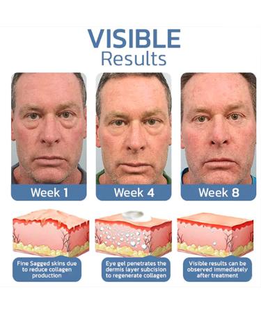 Openeyes Awaken Peptide Lifting Eye Gel - Anti-aging Serum for Men & Women (5Pcs) - Buy Online on GoSupps.com