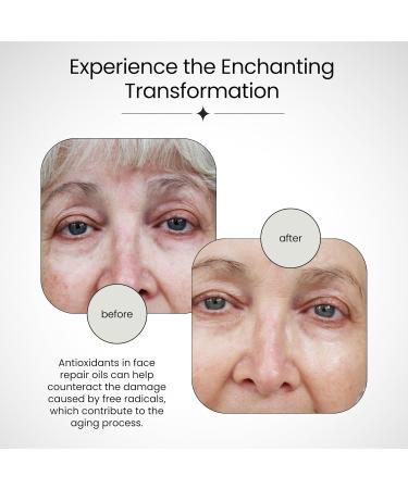 100% Organic Olive Oil Face Oil - Radiant Skin Scar Repair & Anti-Aging Solution (2 fl oz) - International Shipping Available - Buy Online on GoSupps.com