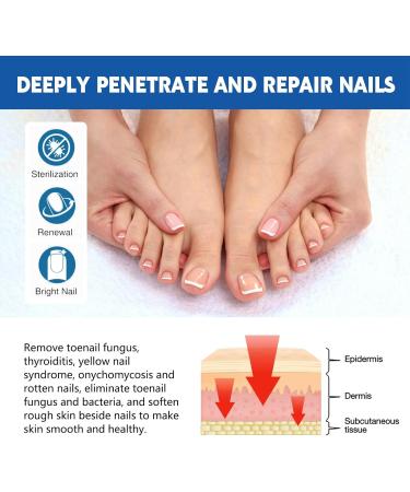 Keratin Nail Growth Oil Nail Strengthener for Damaged Nails - Buy Online on GoSupps.com