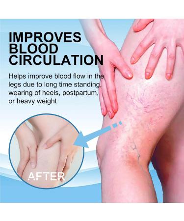 Cr me pour la peau pour les jambes am liore la circulation sanguine et soulage les gonflements liquide pour les varices soulage efficacement les gonflements - Buy Online on GoSupps.com