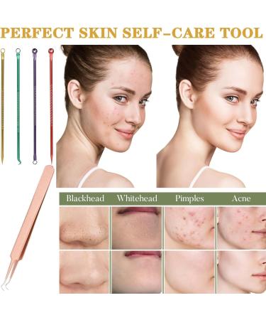 Aruicheng Blackhead Remover Tool Pimple Popping Kit Stainless Steel Comedone Extractor Tools with Storage Box for Removing Pimple Blackheads Acne Zit on Face 5 Pcs - Buy Online on GoSupps.com