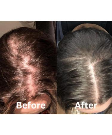 Natural Rosemary Coconut Argan Hair Treatment Serum - Anti-Fall & Biotin Hair Growth Oil by Blossom | International Shipping - Buy Online on GoSupps.com