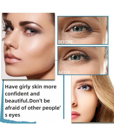 Lactic Acid 10% + Hialuronyc Acid 10% Exfoliating Serum 10% Lactic Acid Serum with Hyaluronic Acid Serum Lactic Acid Serum Face Serum for Women Hydrating Serum Brightening Serum Skincare 30ml - Buy Online on GoSupps.com