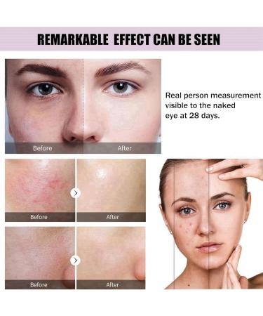 Soothing & Barrier Support Serum Face Serum for Women Face Moisturiser Hydrating&Brightening Serum Skincare Serum Relieves Dry/Tight/Reddened Skin Anti Aging Serum for Face Dark Spot Remover for Face - Buy Online on GoSupps.com