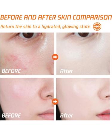 90% Vitamin C Face Cream - Face Cream for Women - Lightening Anti Aging Face Cream for Dark Spots on Face Hands Body - Repair Skin&Face Moisturizer Fade Fine Lines 115g - Buy Online on GoSupps.com