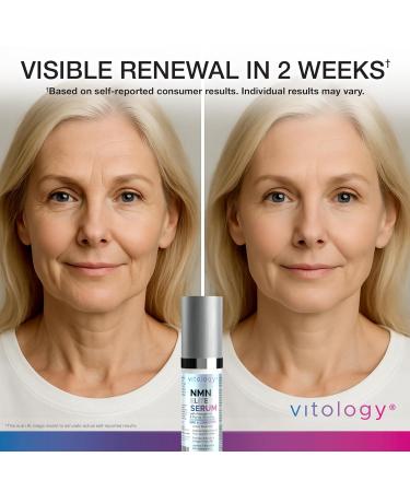 Vitology NMN + Resveratrol Face Serum Cellular Renewal & Anti-Aging Formula with Hyaluronic Acid Aloe & Ginseng Boost NAD Hydrate Firm & Revitalize Skin for Youthful Radiance 1.7 fl oz - Buy Online on GoSupps.com